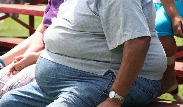 Kanser vakalarının yüzde 40'ı obezite ile bağlantılı